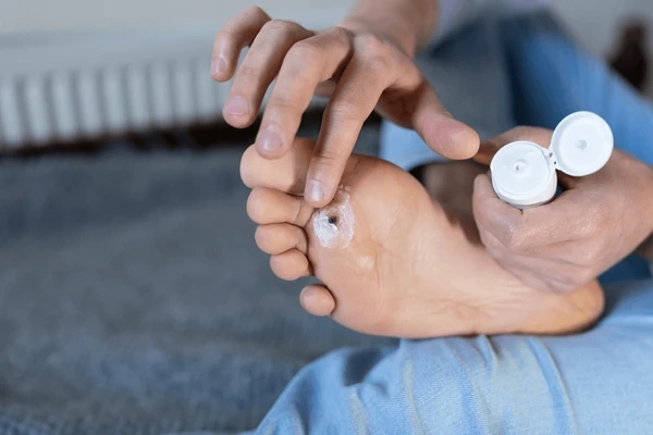 plantar wart treatment in upland, ca